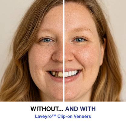 Laveyro™ Clip-on Veneers