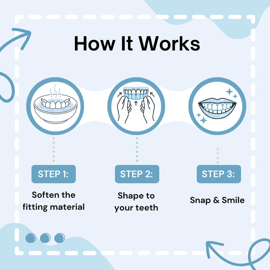 Laveyro™ Clip-on Veneers